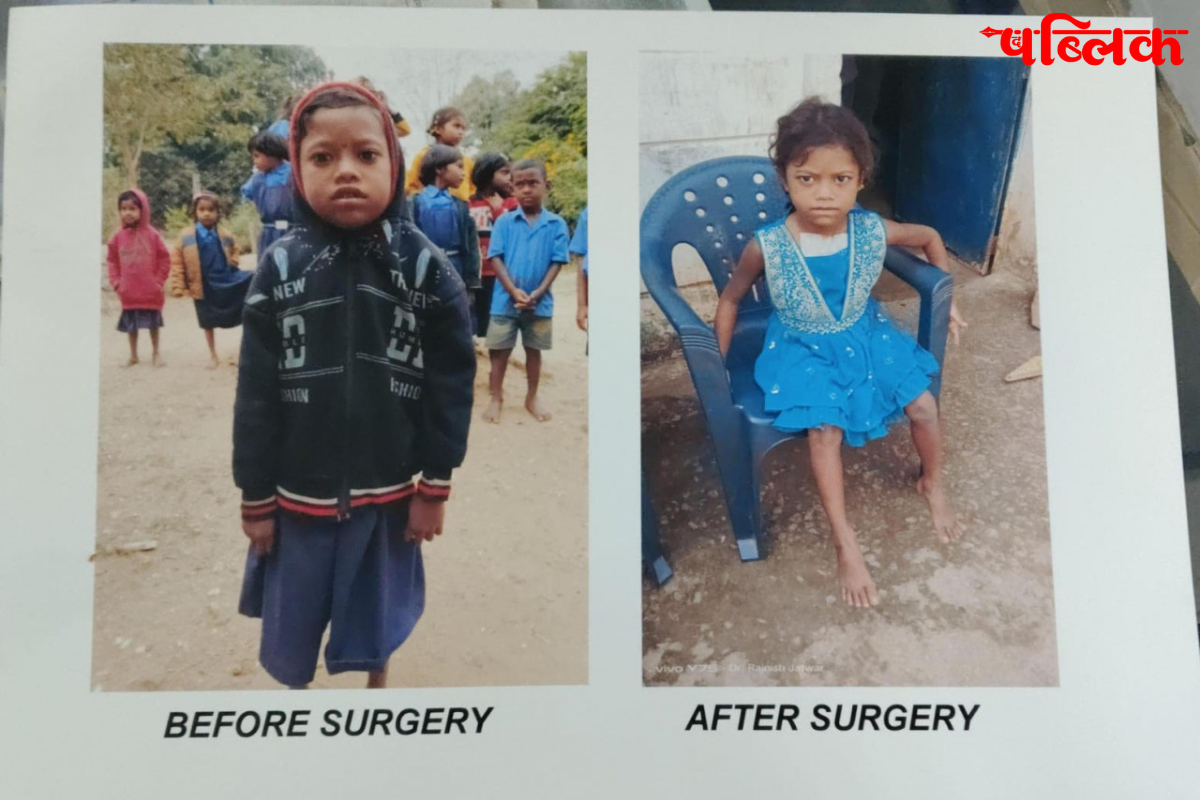 Free Heart Surgery for Children India